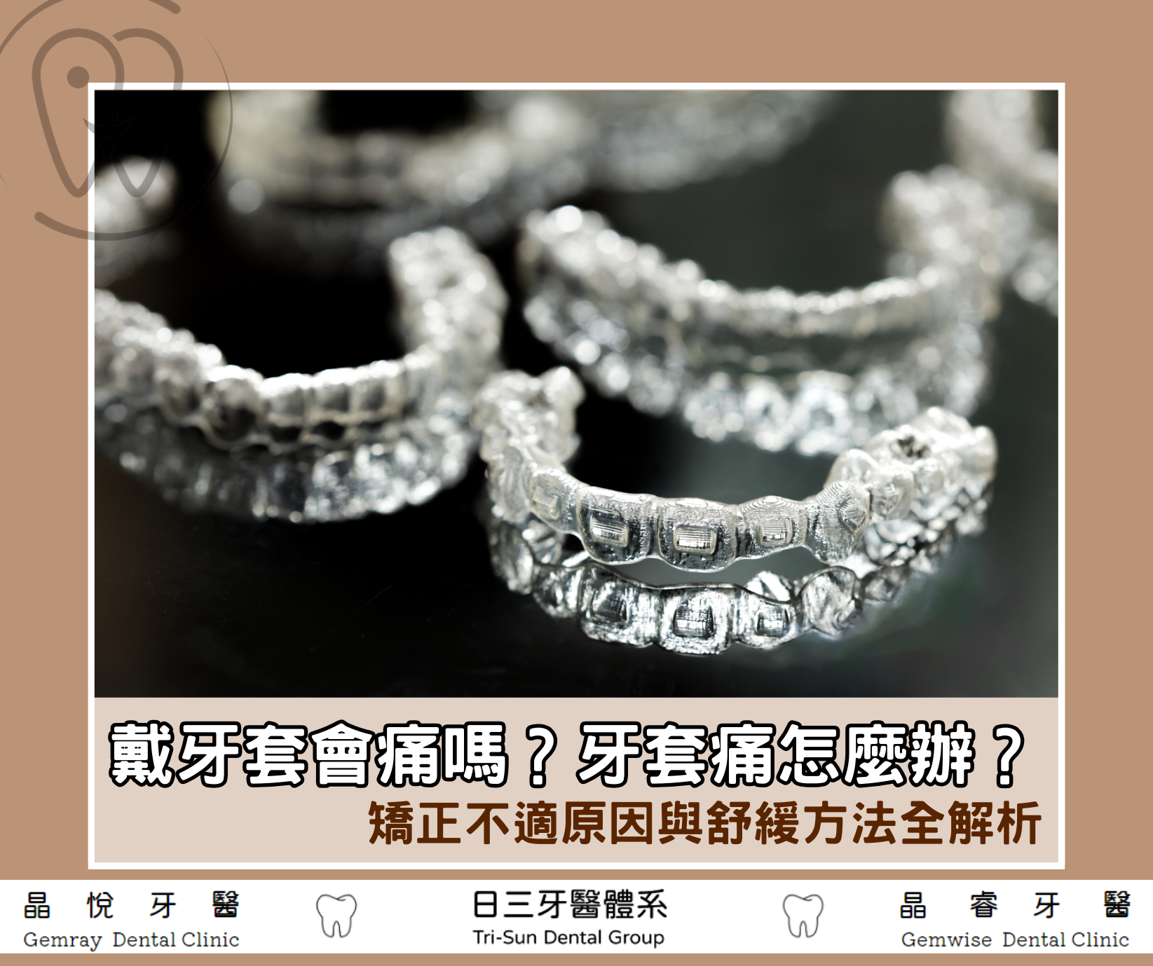 戴牙套會痛嗎？牙套痛怎麼辦？矯正不適原因與舒緩方法全解析