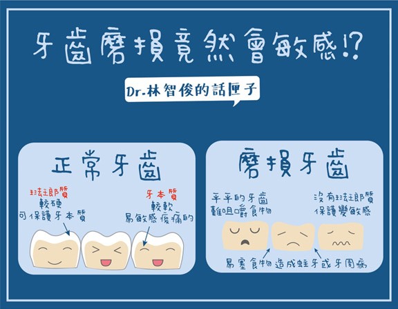【您知道牙齒會敏感,是因為牙齒已經磨損了嗎⁉】 【您知道牙齒會敏感,是因為牙齒已經磨損了嗎⁉】