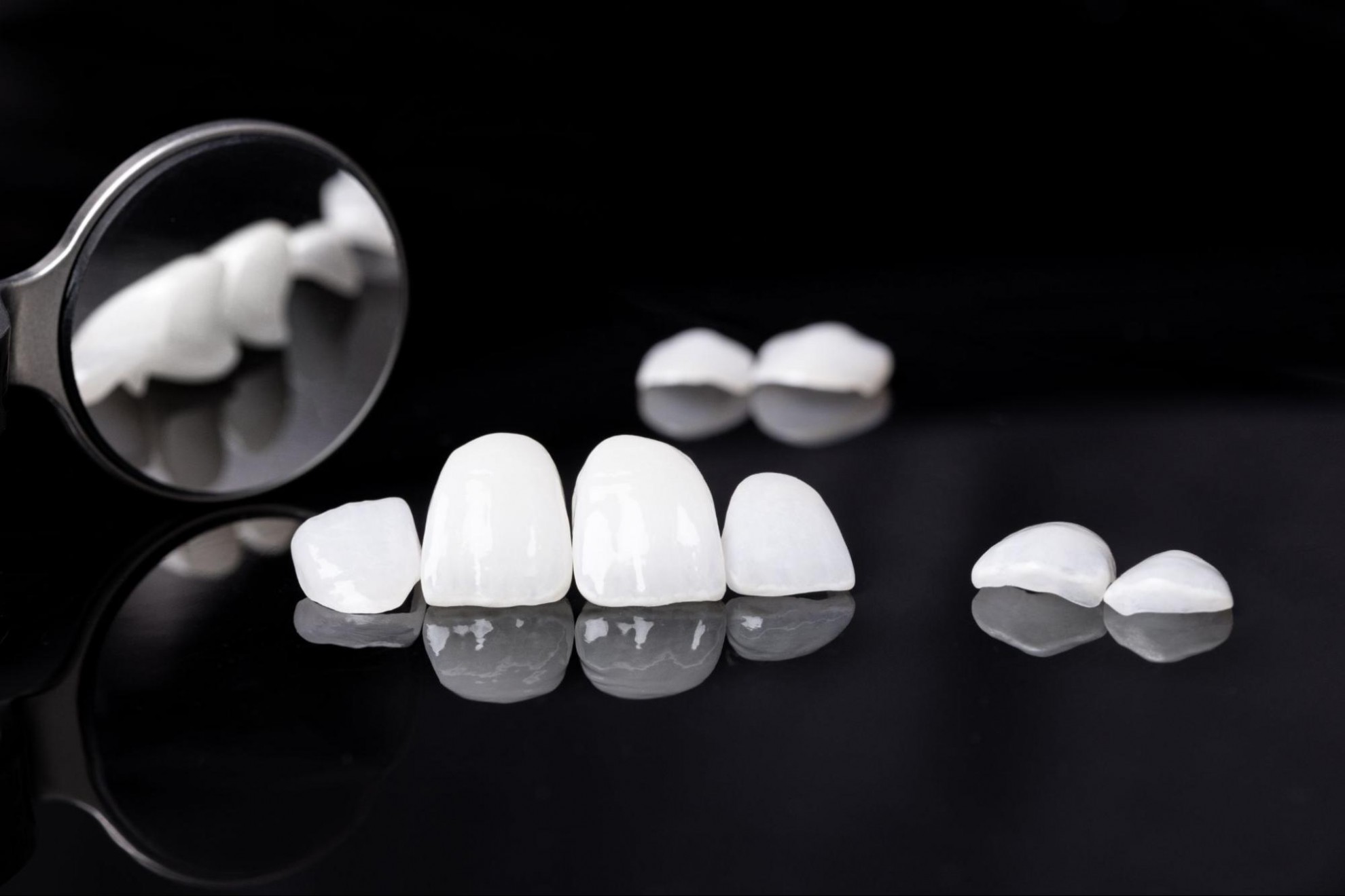 牙冠價格依材質不同而有落差