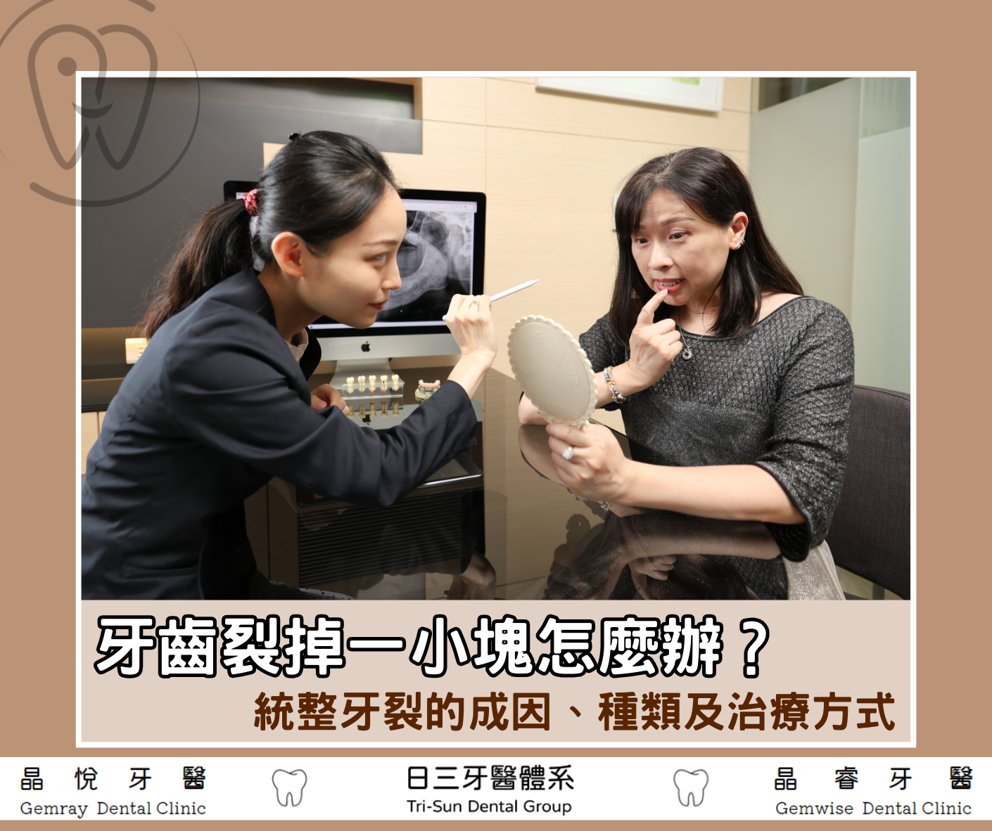 牙齒裂掉一小塊怎麼辦？統整4種牙齒裂掉原因、治療方式