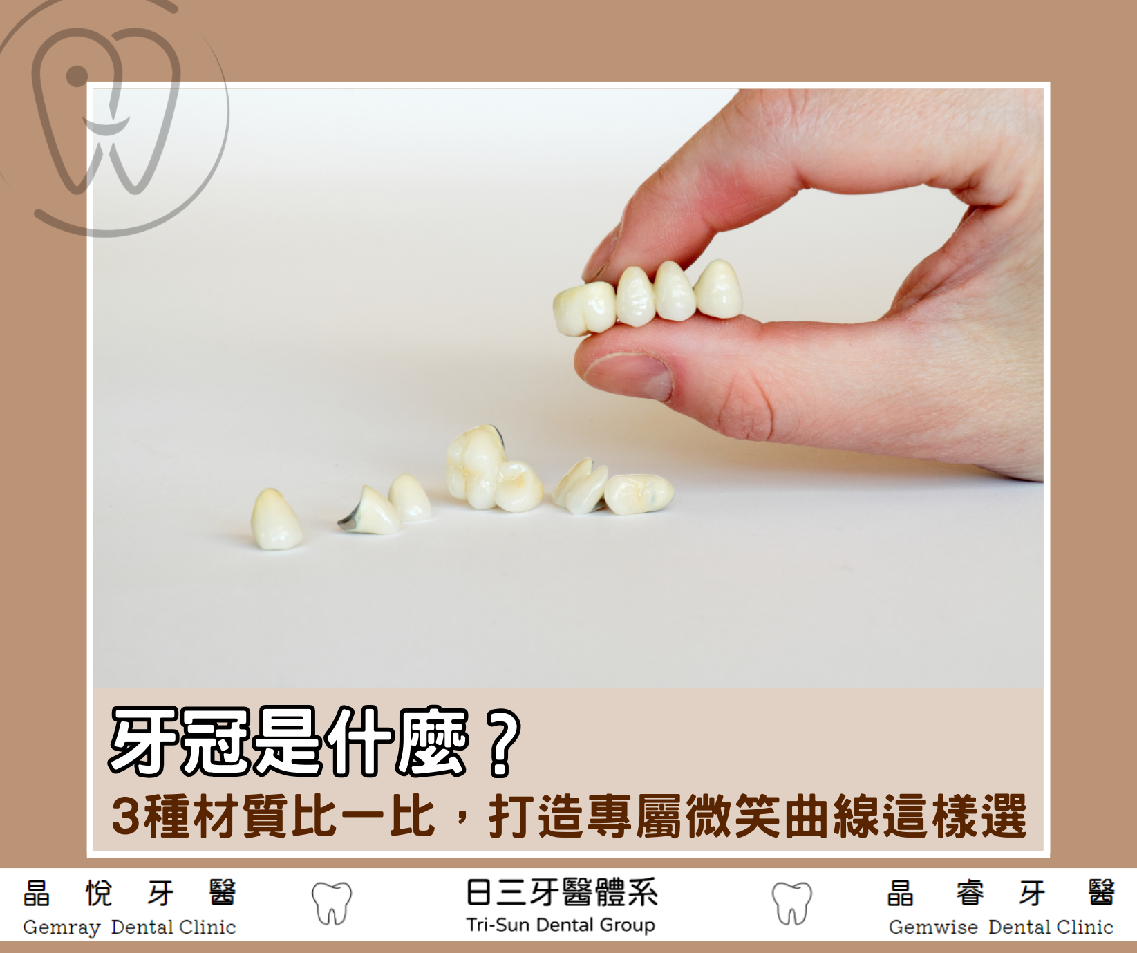 牙冠是什麼？3種材質比一比，打造專屬微笑曲線這樣選！
