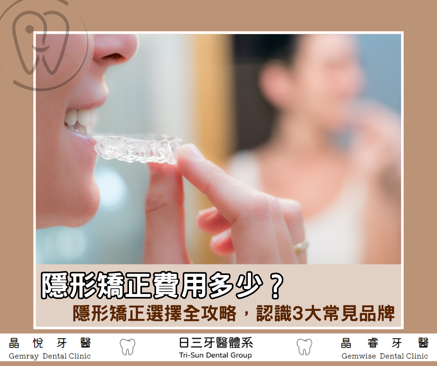 隱形矯正費用多少？隱形矯正選擇全攻略，認識3大常見品牌