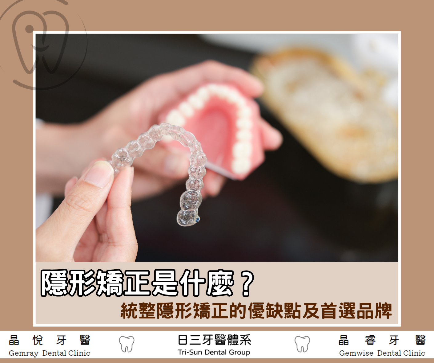 隱形牙套比較好？隱形矯正優缺點比較、品牌挑選推薦！