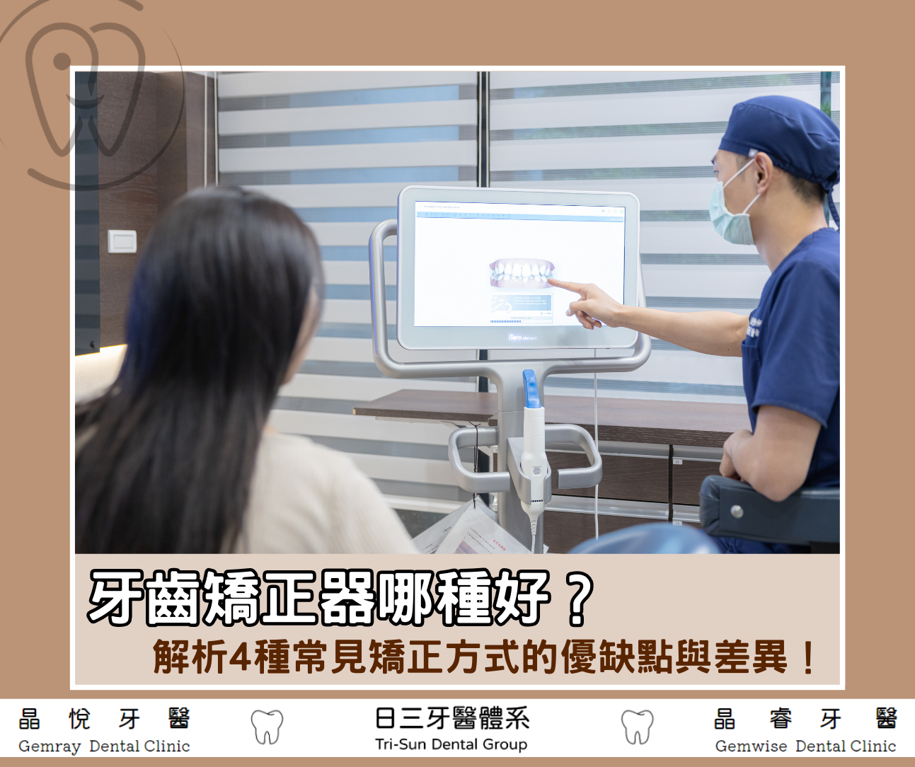 牙齒矯正器哪種好？解析4種常見矯正方式的優缺點與差異！