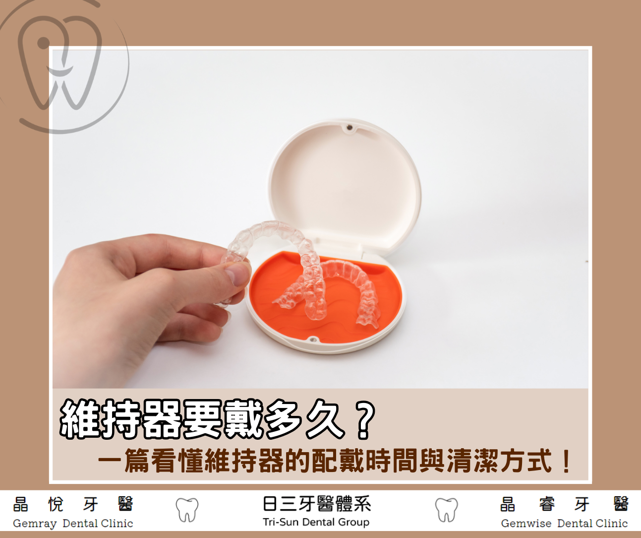 維持器要戴多久？多久換一副？一篇看懂維持器配戴重點