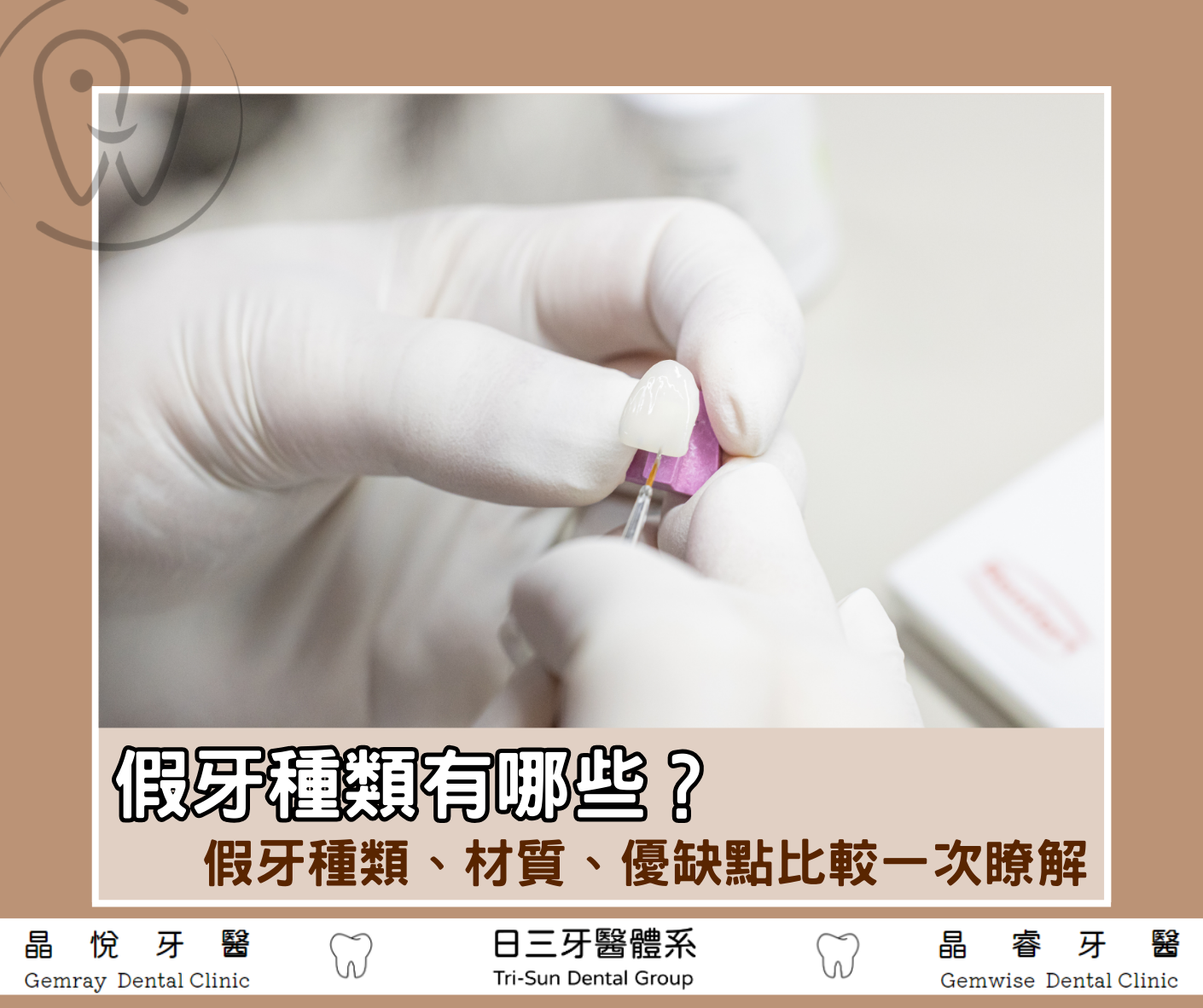 假牙種類怎麼選？4大假牙種類、3大材質、優缺點完整比較