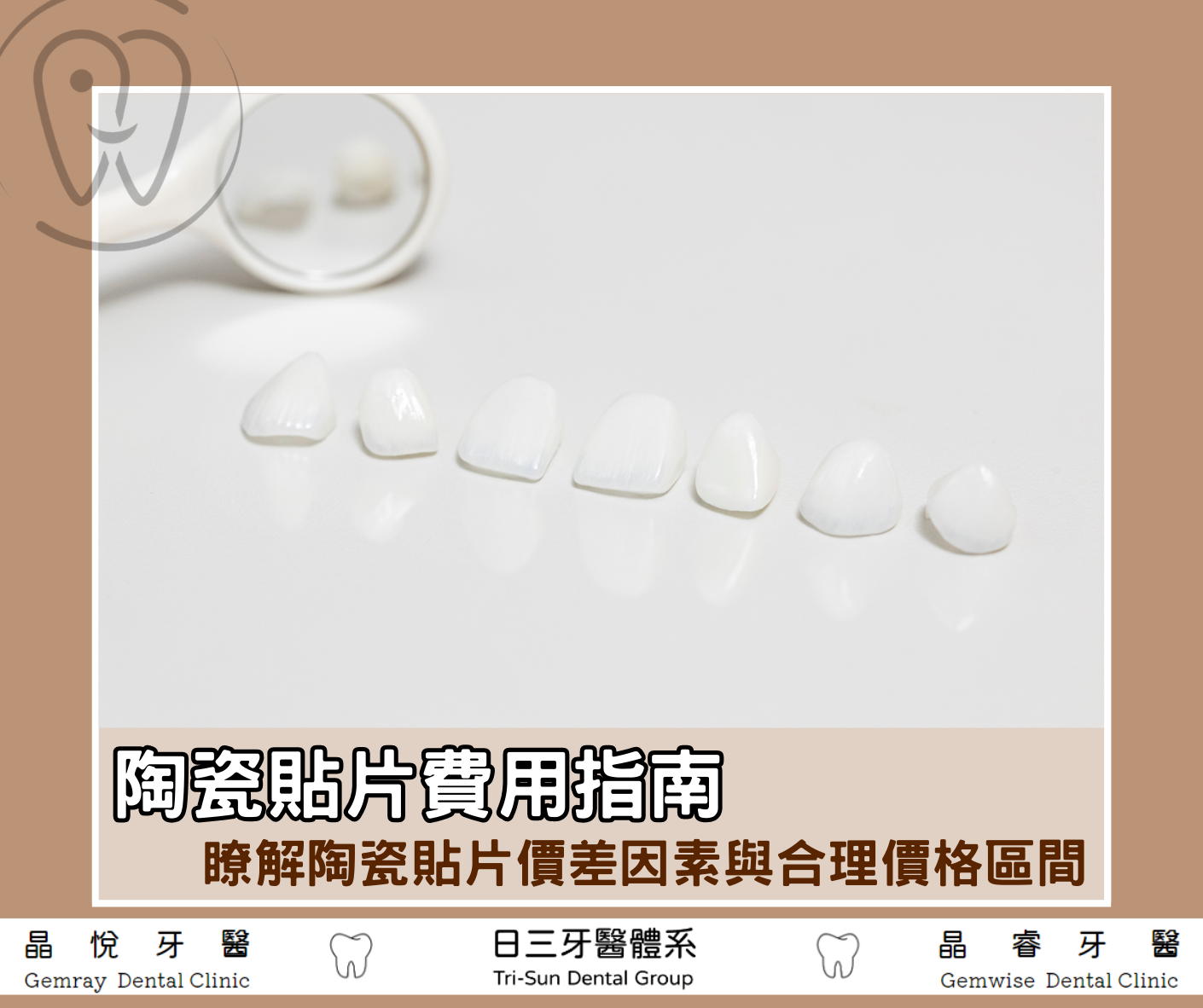 陶瓷貼片費用指南》一篇瞭解陶瓷貼片價差因素與合理價格區間