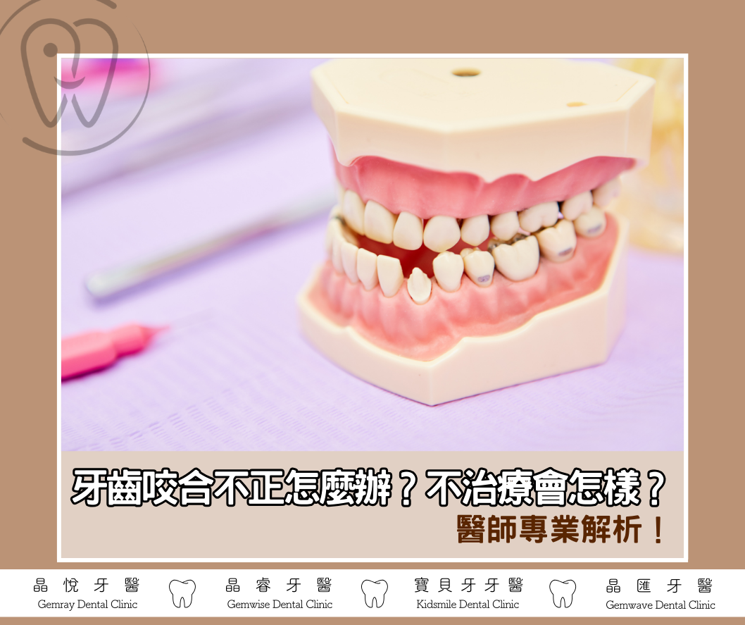 牙齒咬合不正怎麼辦？不治療會怎樣？醫師專業解析！