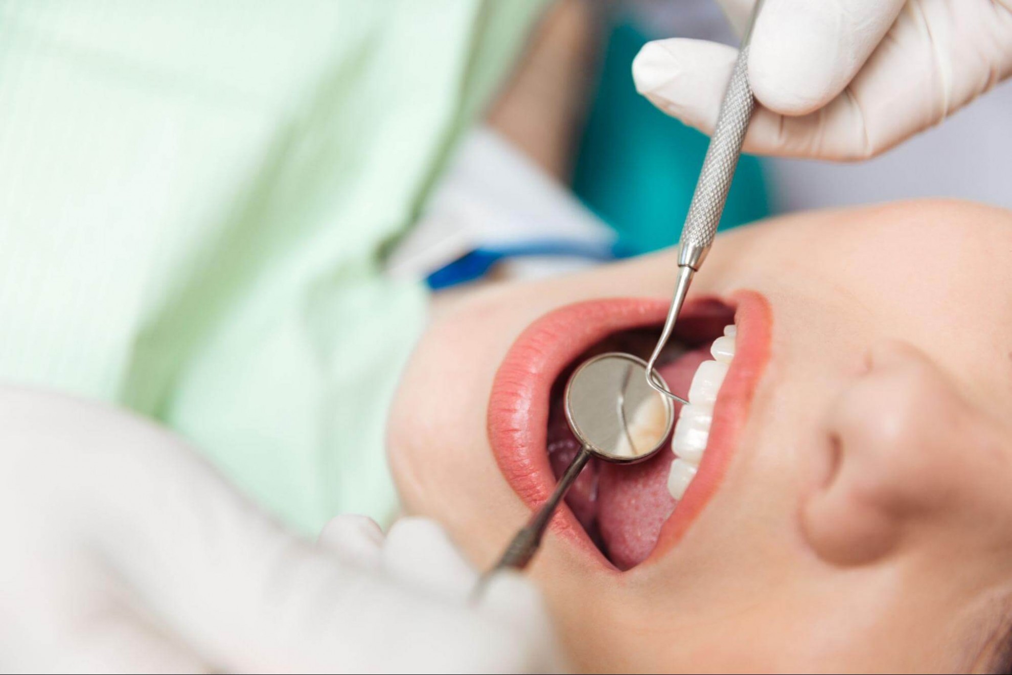 影響牙周病治療費用的因素包含病況嚴重度、治療方式、材料品質及醫師專業度