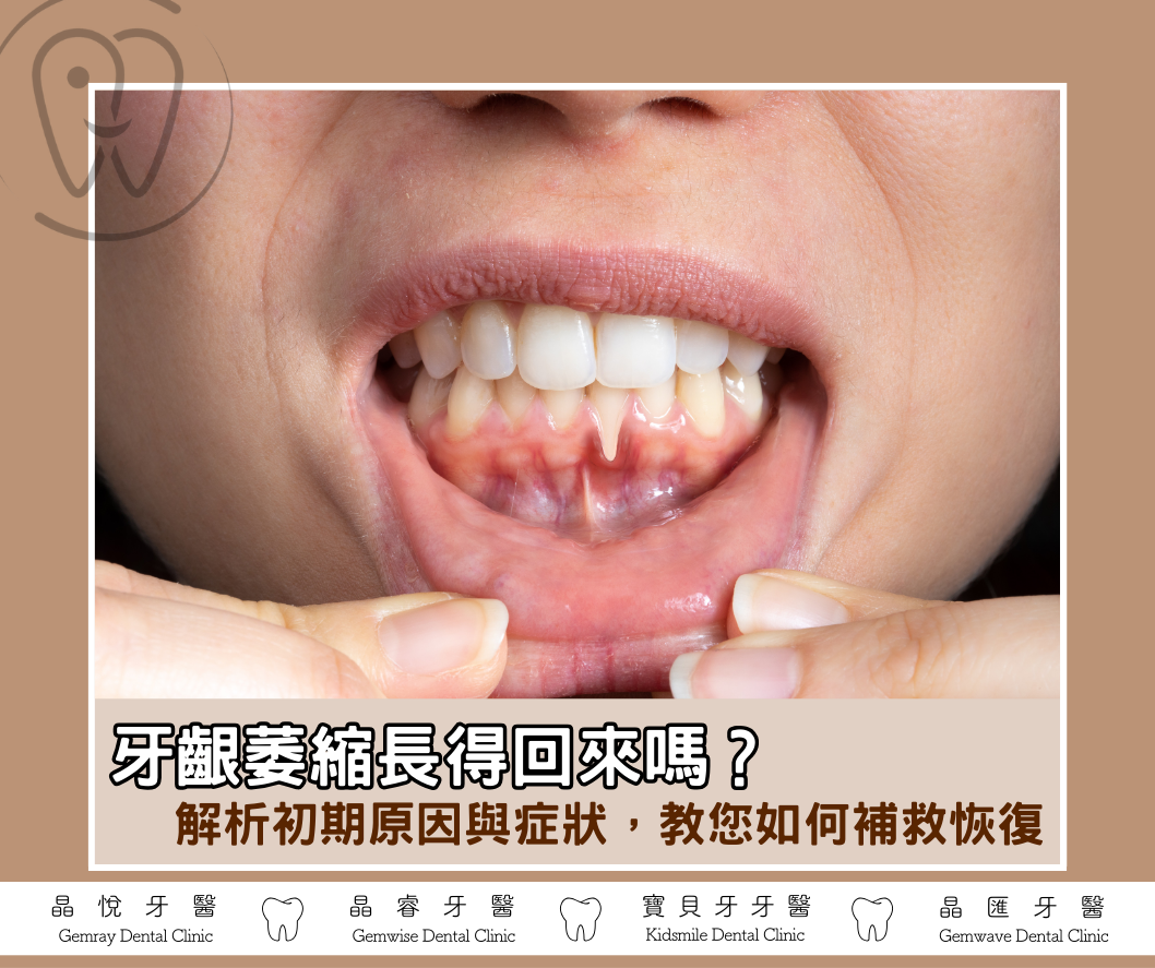 牙齦萎縮長得回來嗎？解析初期原因與症狀，教您如何補救恢復
