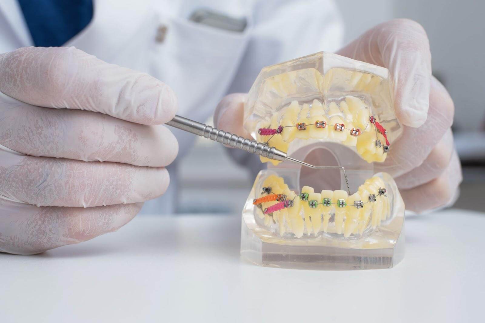 在咬合不正的矯正路上，日三牙醫體系的專業團隊將全程陪伴您度過每一個時刻。