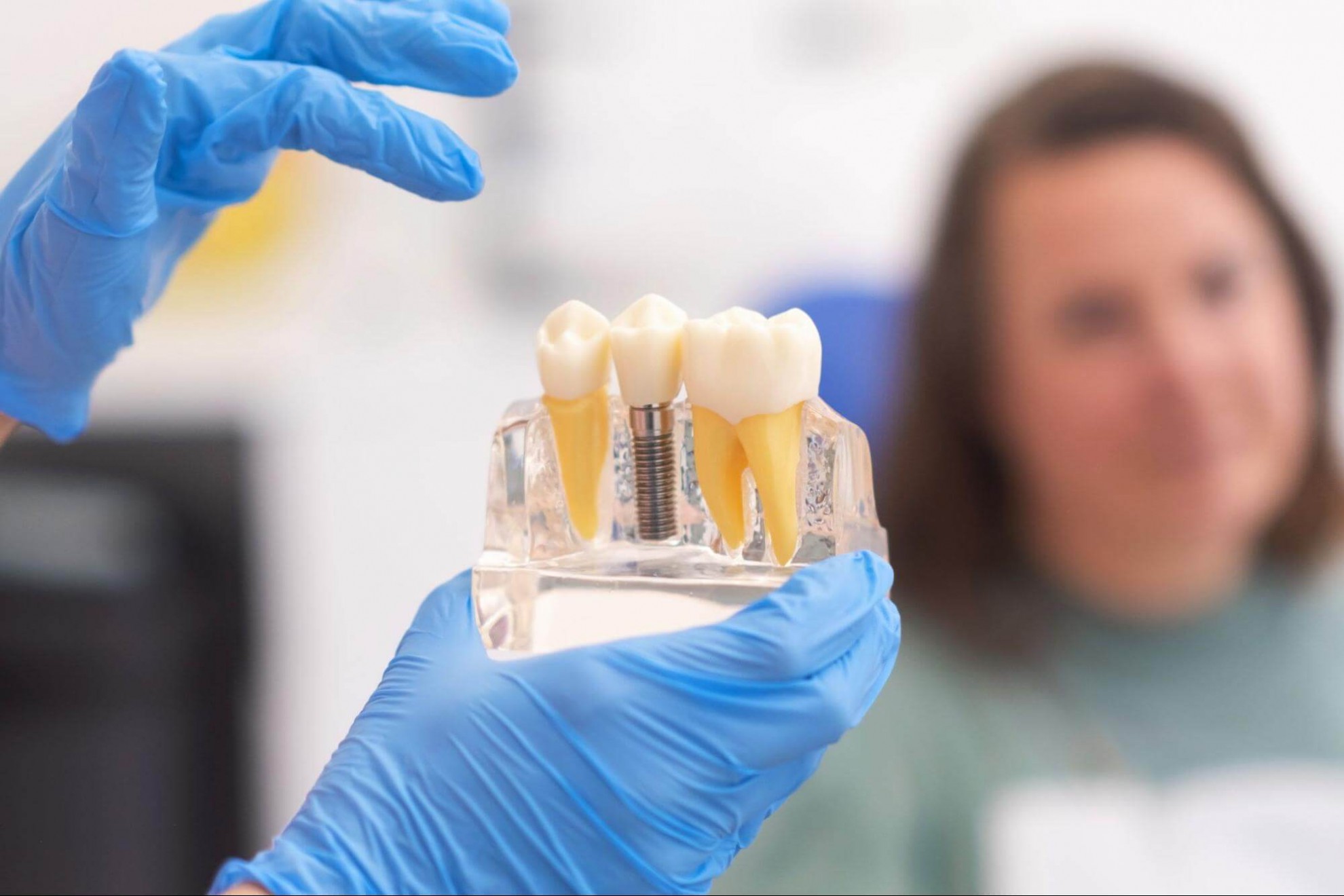 哪些人適合做 all on 4 植牙？