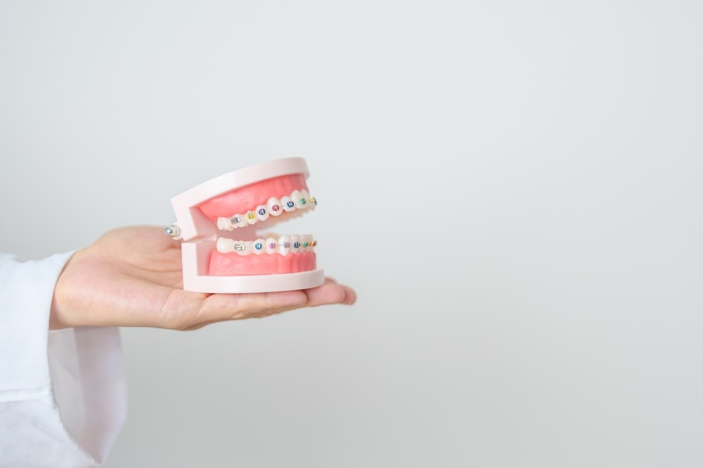 牙齒矯正器哪種好?解析4種常見矯正方式的優缺點與差異! 各種牙齒矯正器的優缺點說明