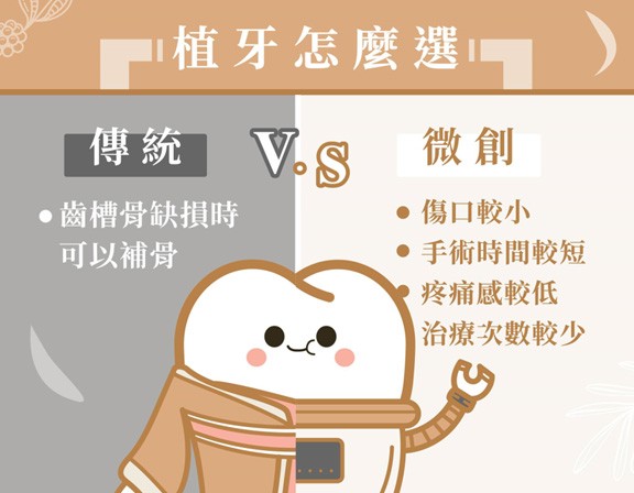 【植牙怎麼選?】 【植牙怎麼選?】