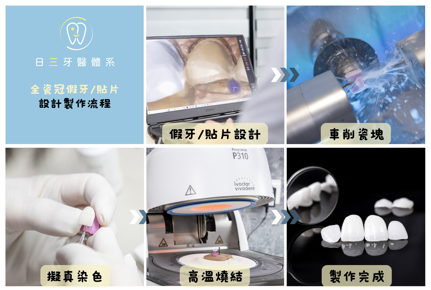 從害羞遮笑到自信露齒 從害羞遮笑到自信露齒