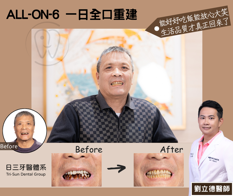 能吃飯能大笑 找回好的生活品質 能吃飯能大笑 找回好的生活品質