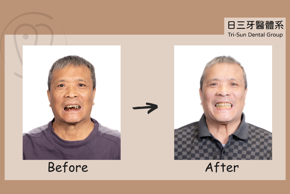 能吃飯能大笑 找回好的生活品質 能吃飯能大笑 找回好的生活品質