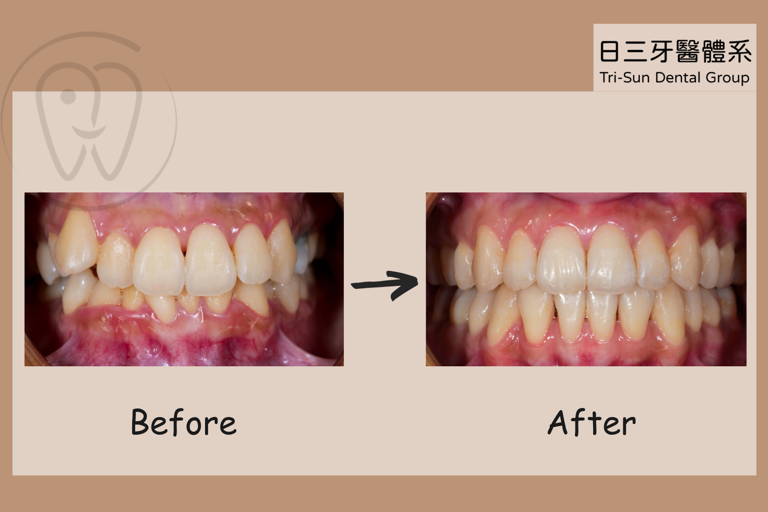 別讓亂牙成為生活中的阻礙