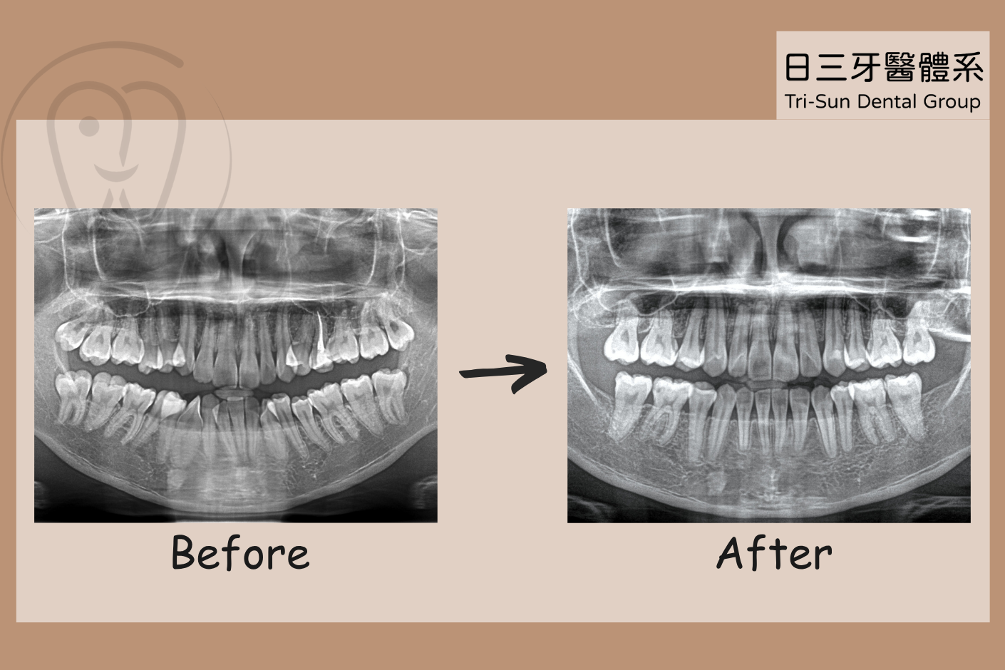 別讓亂牙成為生活中的阻礙