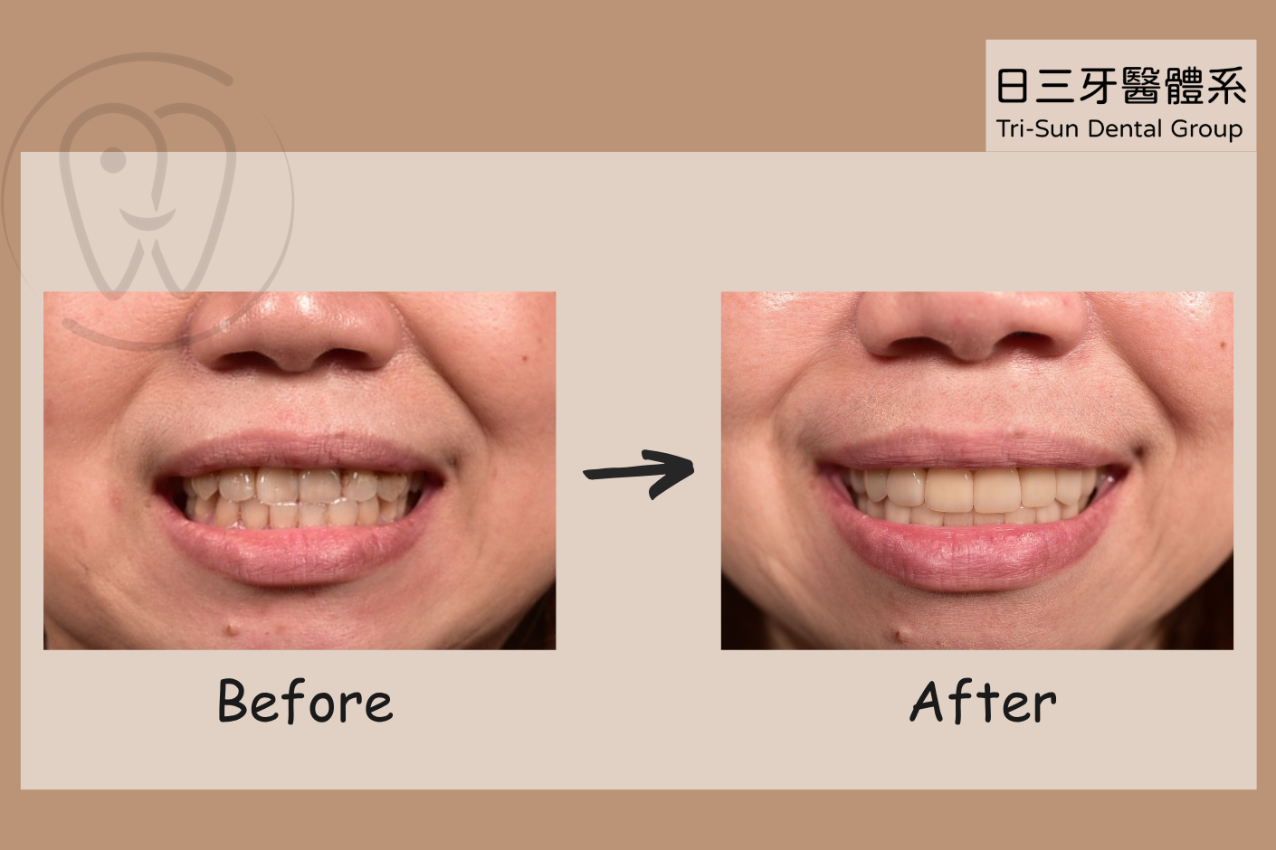 微笑蛻變的旅程 微笑蛻變的旅程