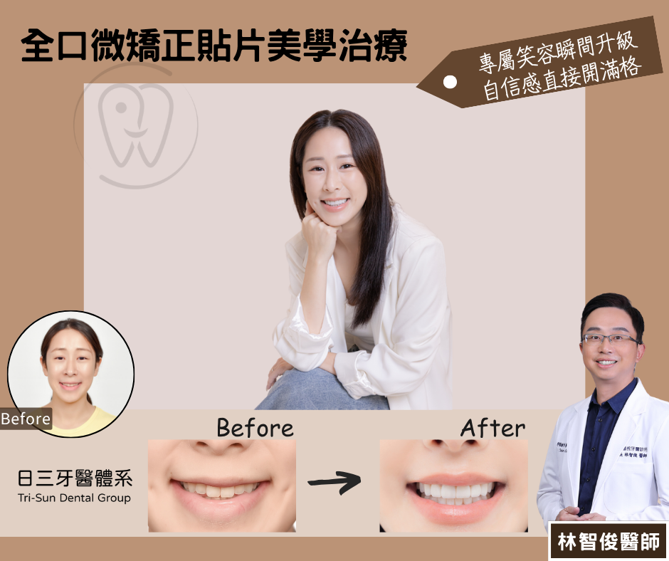 笑容瞬間升級 自信感直接開滿格 笑容瞬間升級 自信感直接開滿格