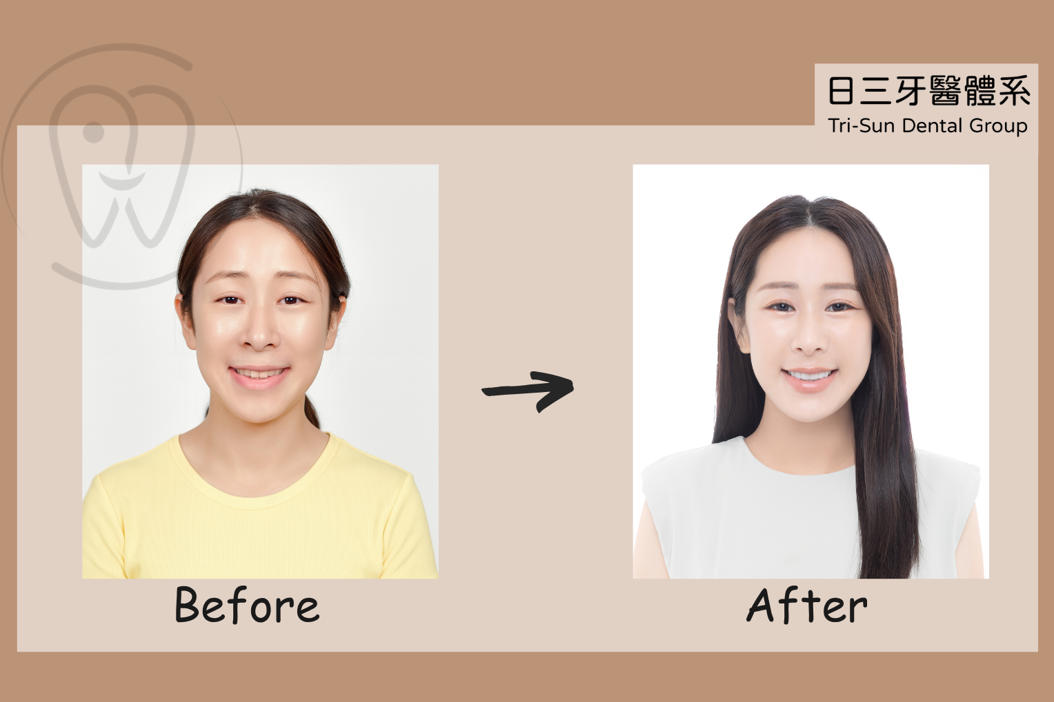 笑容瞬間升級 自信感直接開滿格 笑容瞬間升級 自信感直接開滿格