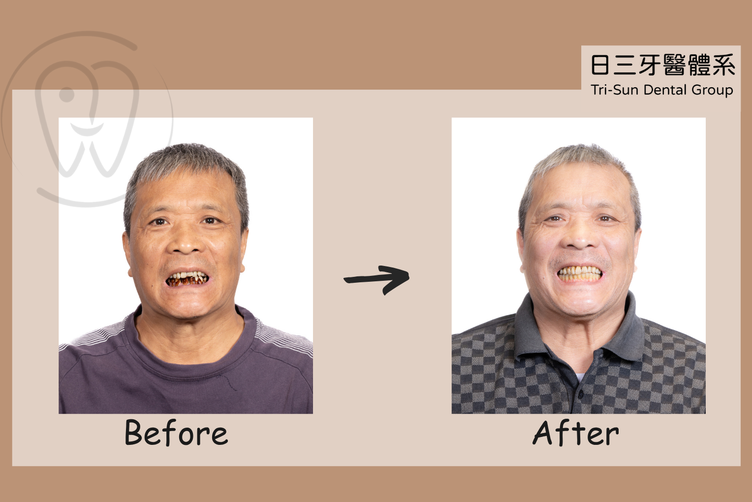 能吃飯能大笑 找回好的生活品質 能吃飯能大笑 找回好的生活品質