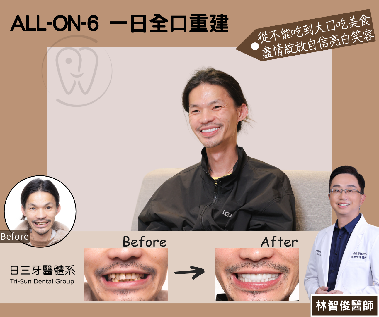 大口吃美食 自信綻放笑容 大口吃美食 自信綻放笑容