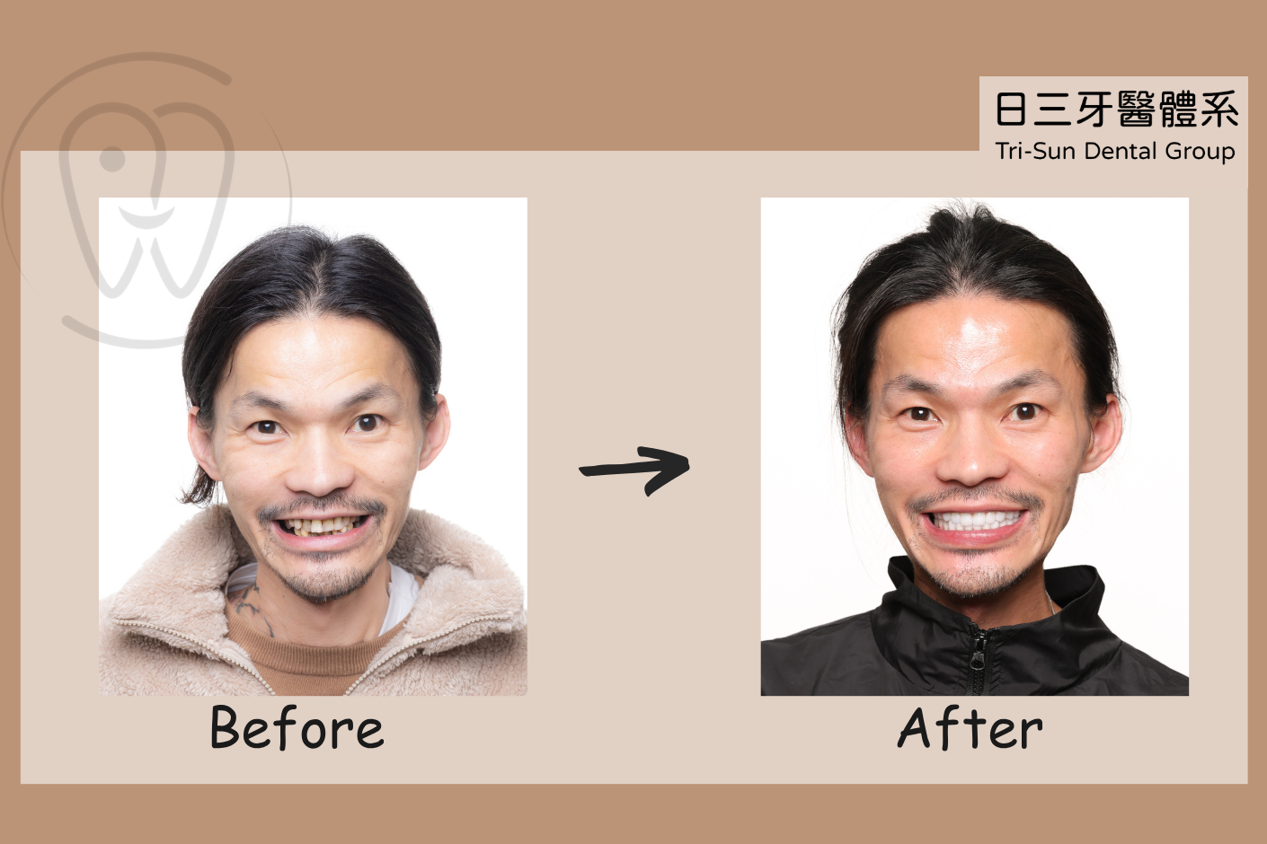 大口吃美食 自信綻放笑容 大口吃美食 自信綻放笑容