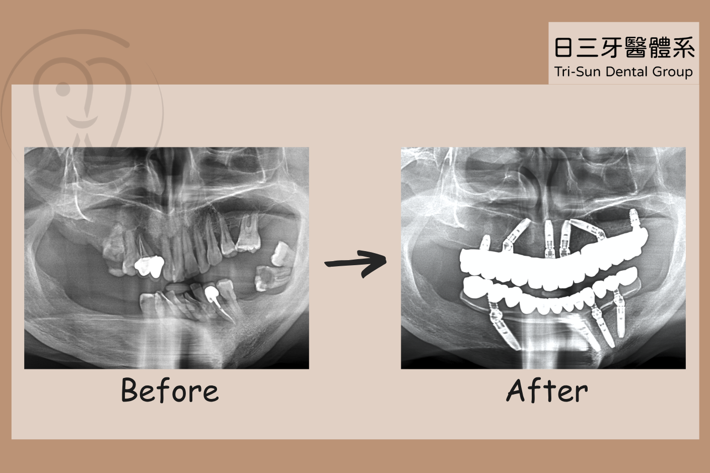 大口吃美食 自信綻放笑容 大口吃美食 自信綻放笑容