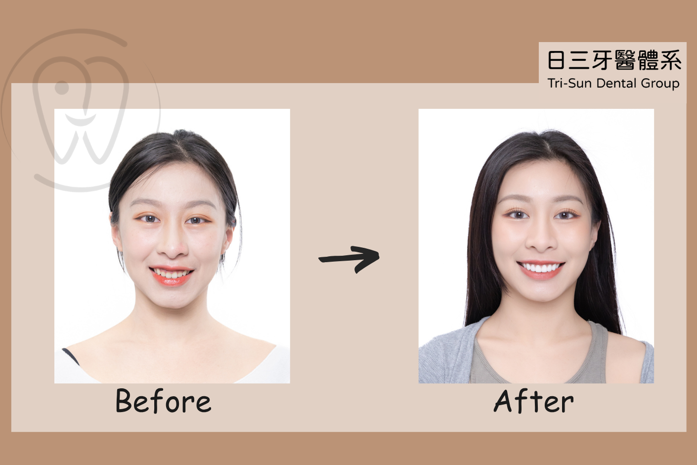 即使鏡頭再靠近 依然自信綻放笑容 即使鏡頭再靠近 依然自信綻放笑容