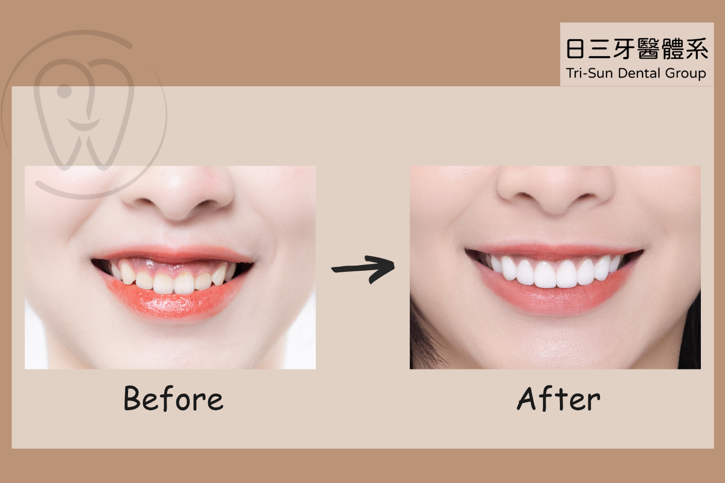 即使鏡頭再靠近 依然自信綻放笑容 即使鏡頭再靠近 依然自信綻放笑容