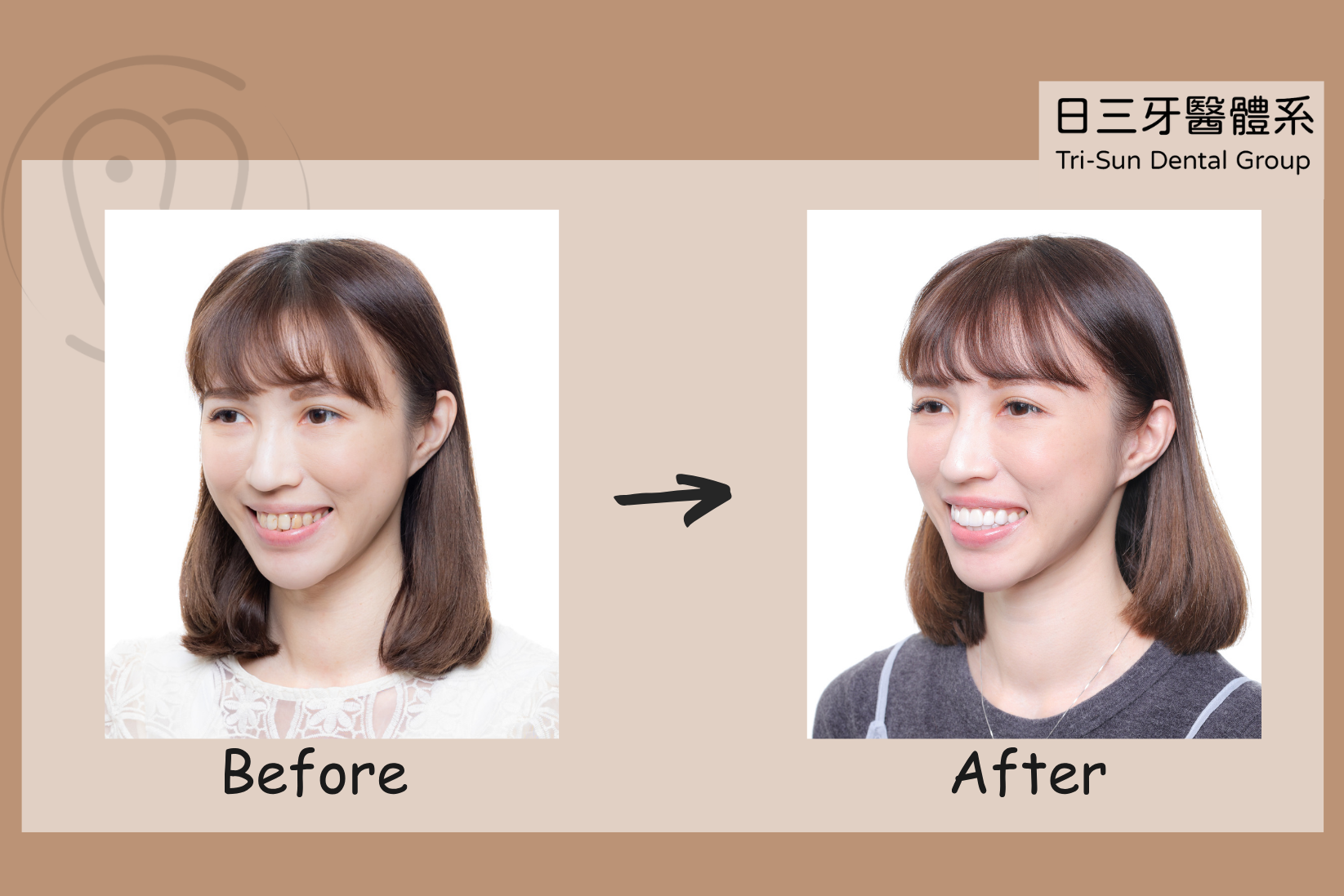 從害羞遮笑到自信露齒