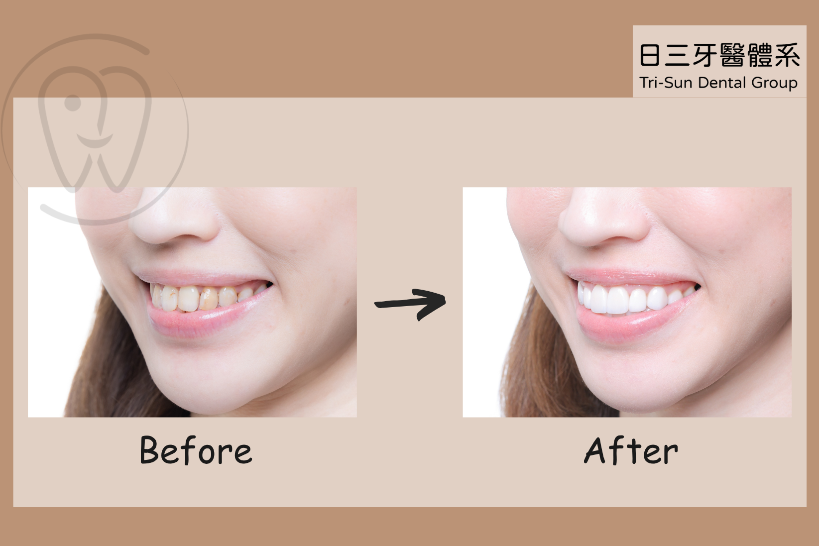 從害羞遮笑到自信露齒