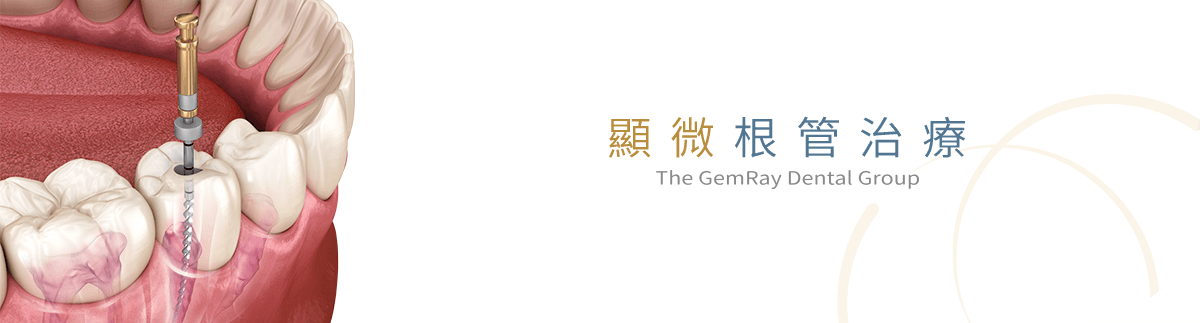 顯微根管治療 顯微根管治療