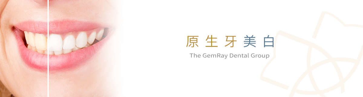 原生牙美白 原生牙美白