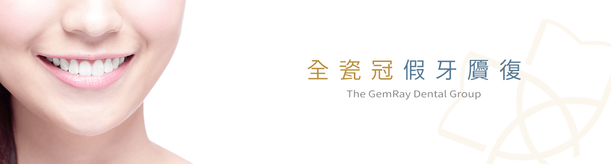 全瓷冠假牙贗復 全瓷冠假牙贗復
